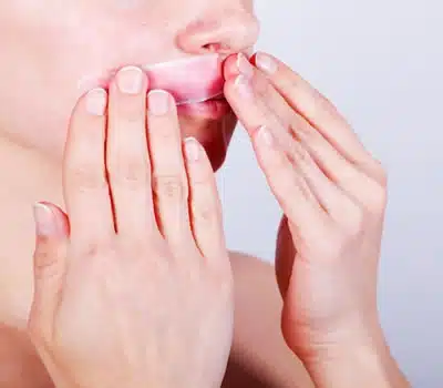 Local de Aplicação das Ceras Frias para Depilação